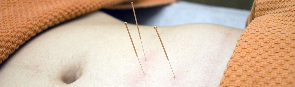 Accupuncture, Eastern Healing Arts in the Hunterdon County, NJ area